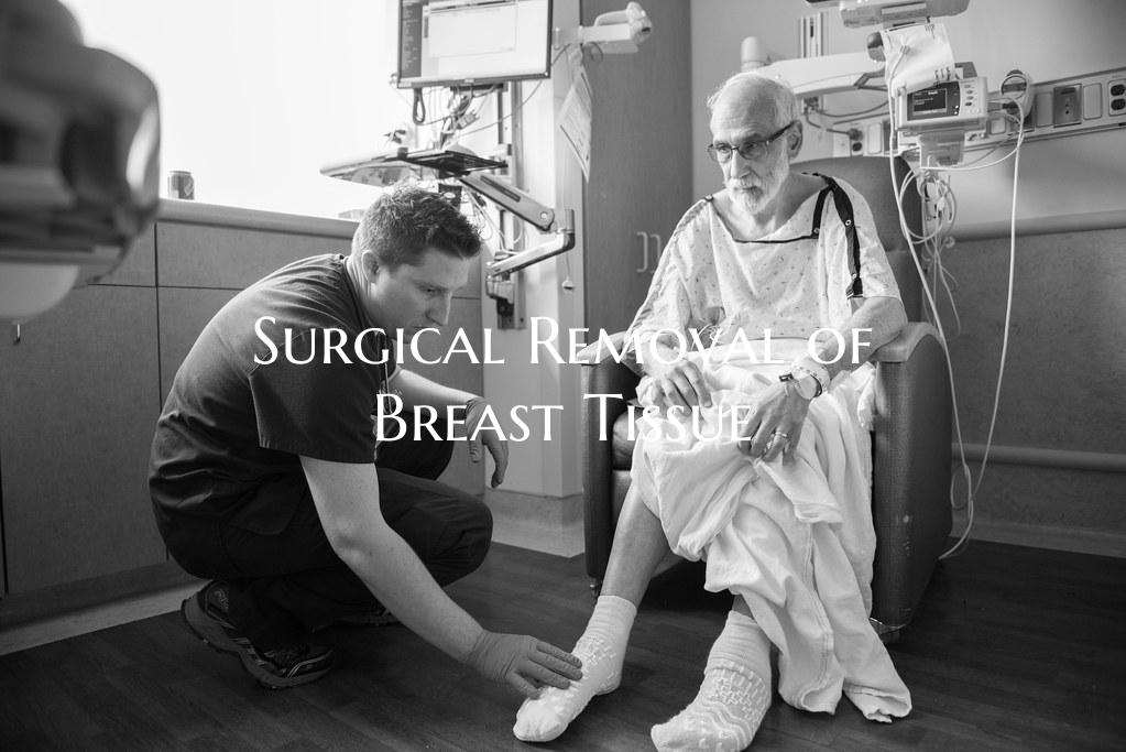 Surgical Removal of Breast Tissue