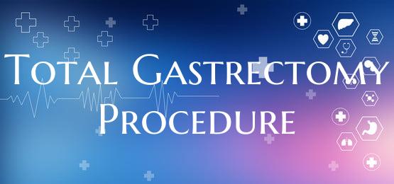 Total Gastrectomy Procedure