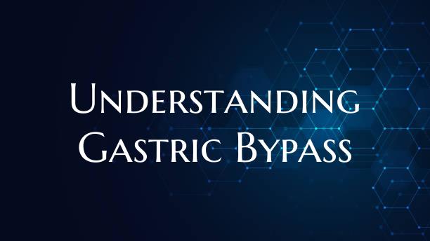 Understanding Gastric Bypass
