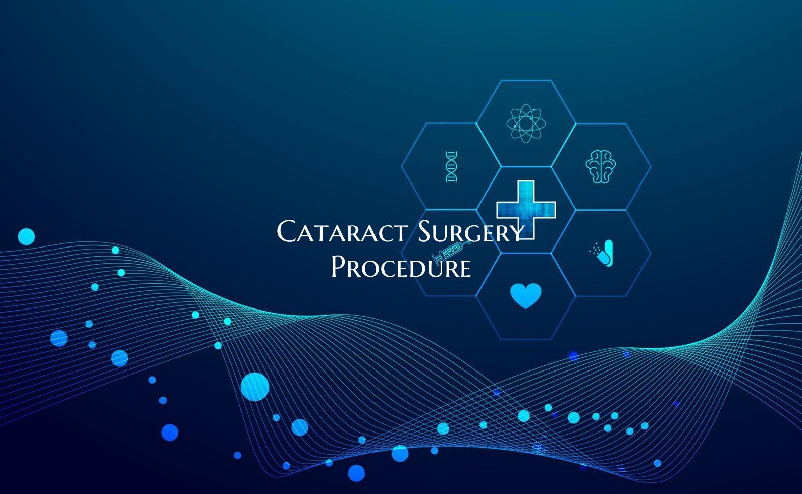 Cataract Surgery Procedure