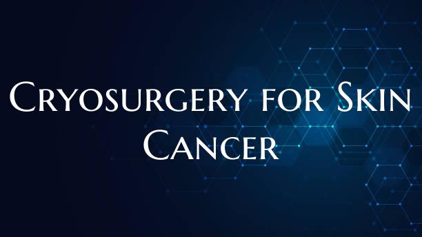 Cryosurgery for Skin Cancer