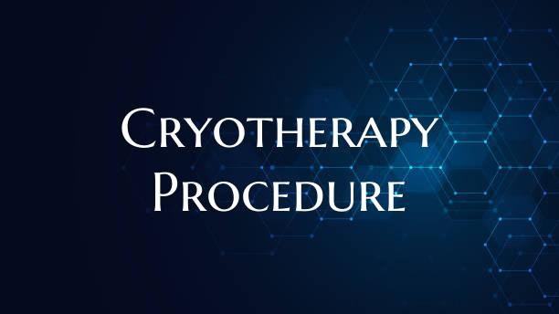 Cryotherapy Procedure