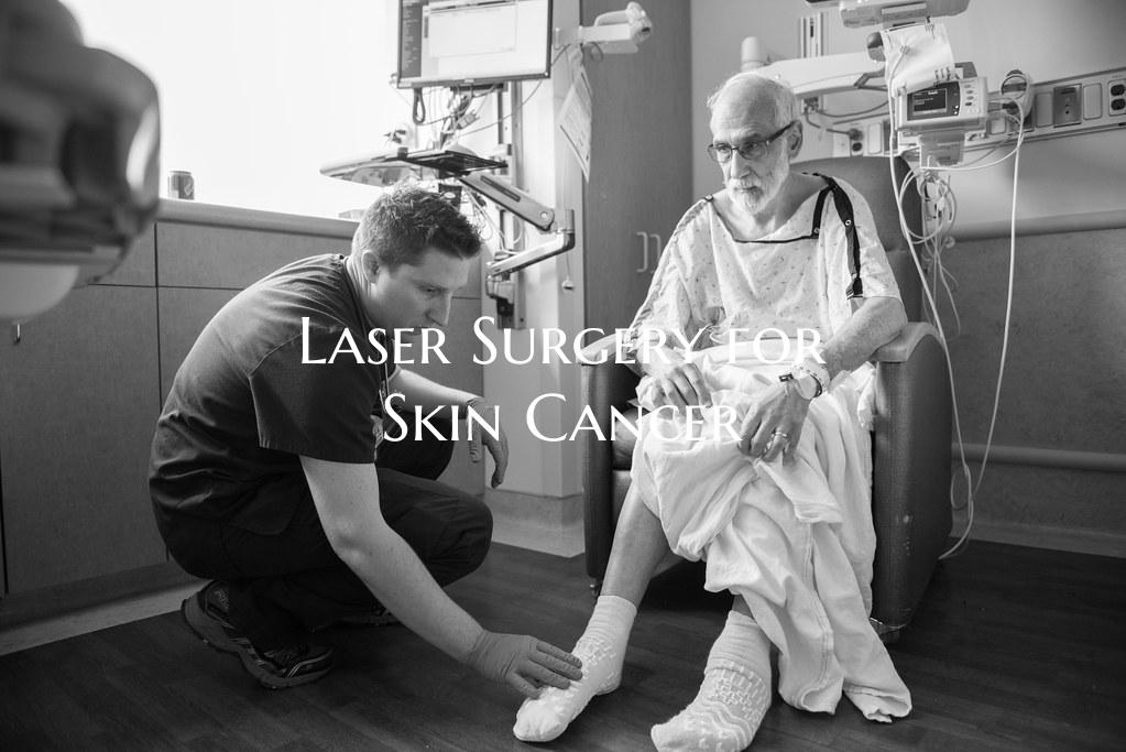 Laser Surgery for Skin Cancer