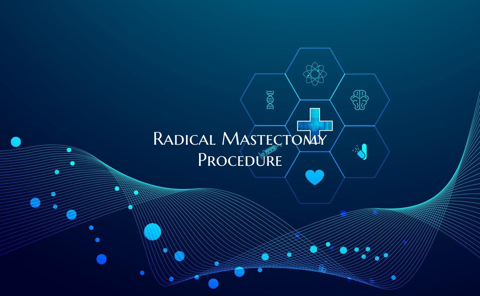 Radical Mastectomy Procedure